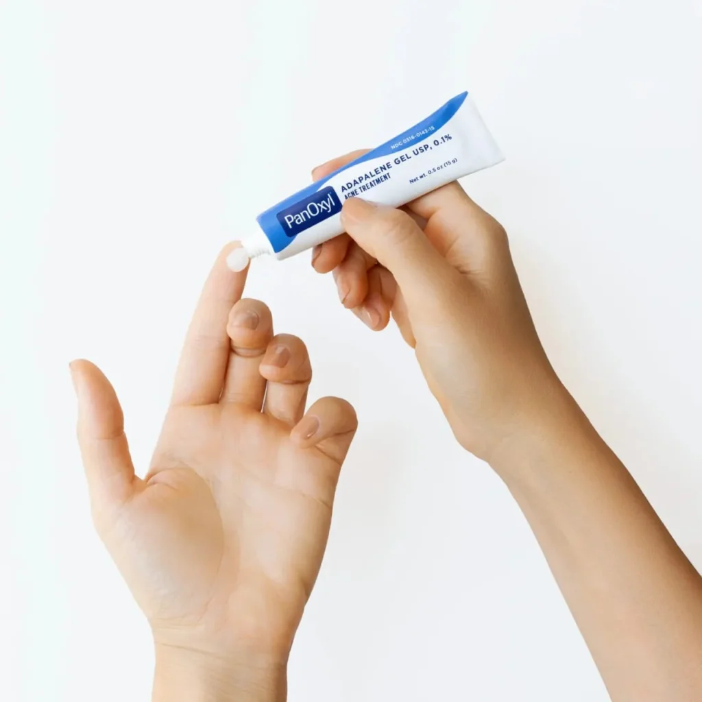 Adapalene vs Retinol: What’s Better for Acne-Prone Aging Skin?