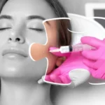 Rejuvenate from Within: The Power of Sculptra and Collagen Stimulation