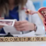 Finding Support for Those Affected by Silent Endometriosis