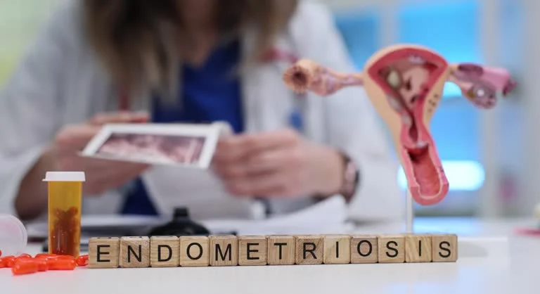endometriosis