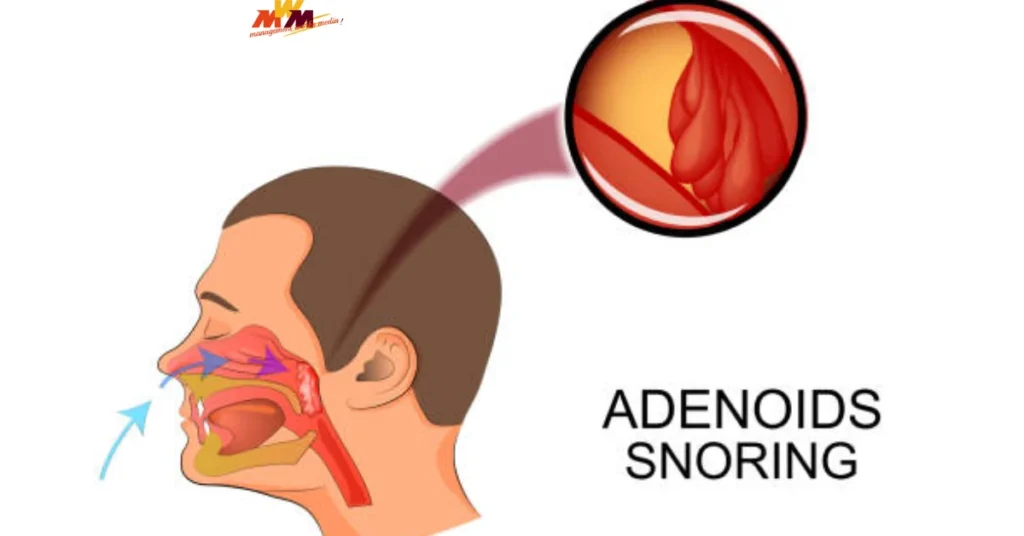 Adenoidid