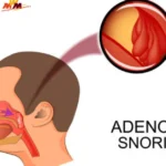 Adenoidid Demystified: From Medical Insight to Practical Parental Advice