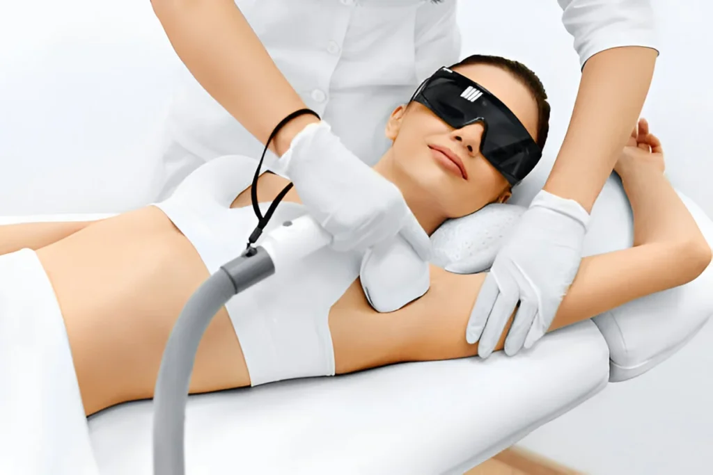 Laser Hair Removal