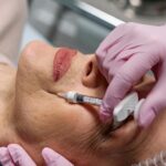 Choosing a Botox Injector: Safe, Natural Results That Last