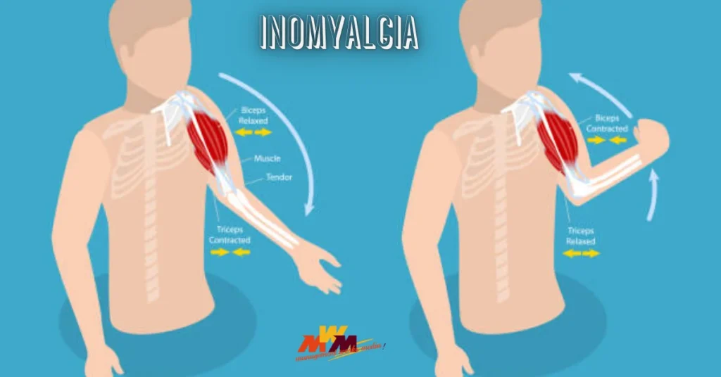 inomyalgia