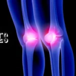 Attrities: Symptoms, Causes, and Its Role in Limiting Joint Function
