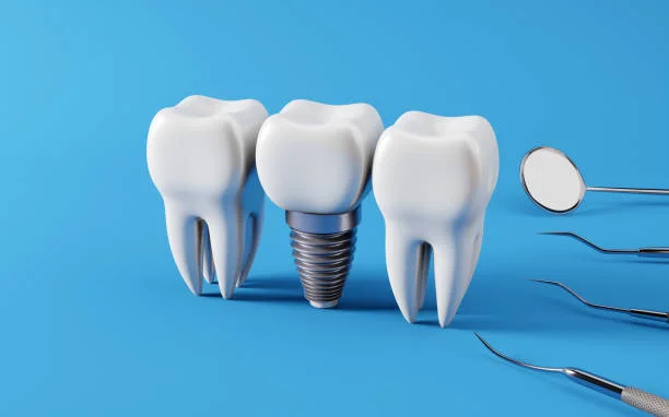 Dental implant surgery