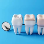 The Advantages of Ceramic Dental Restorations