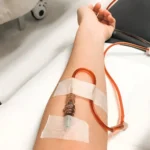 Why Are More People Choosing Iron IV Infusion Therapy for Wellness?
