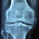 Holistic Approaches to Maintaining Joint Health for Busy Professionals