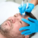 Achieve Smooth, Glowing Skin with CO2 Laser Resurfacing in Scottsdale