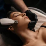 Unlock Radiant Skin with Advanced RF Microneedling at Elite Body Contouring