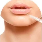 Buy Dermal Fillers Online USA: A Complete Guide (2025 Tutorial & Industry Update)