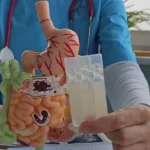 Understanding the Importance of a Reliable SIBO Test for Digestive Health