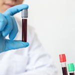 Dutch Test Singapore: A Step-By-Step Breakdown Of The Hormone Testing Process