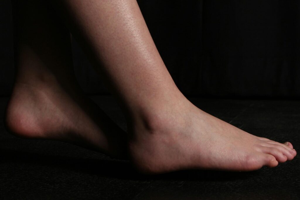 The Hidden Causes of Heel Pain Most People Ignore