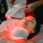 Unlock Radiant Glow: Ultimate Guide to Skin Rejuvenation in London