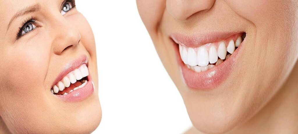 How Dentists Help You Get a White, Perfect Smile Every Time