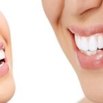How Dentists Help You Get a White, Perfect Smile Every Time