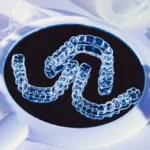 Straighten Up, Australia! Invisalign Tech for Your Best Smile Yet