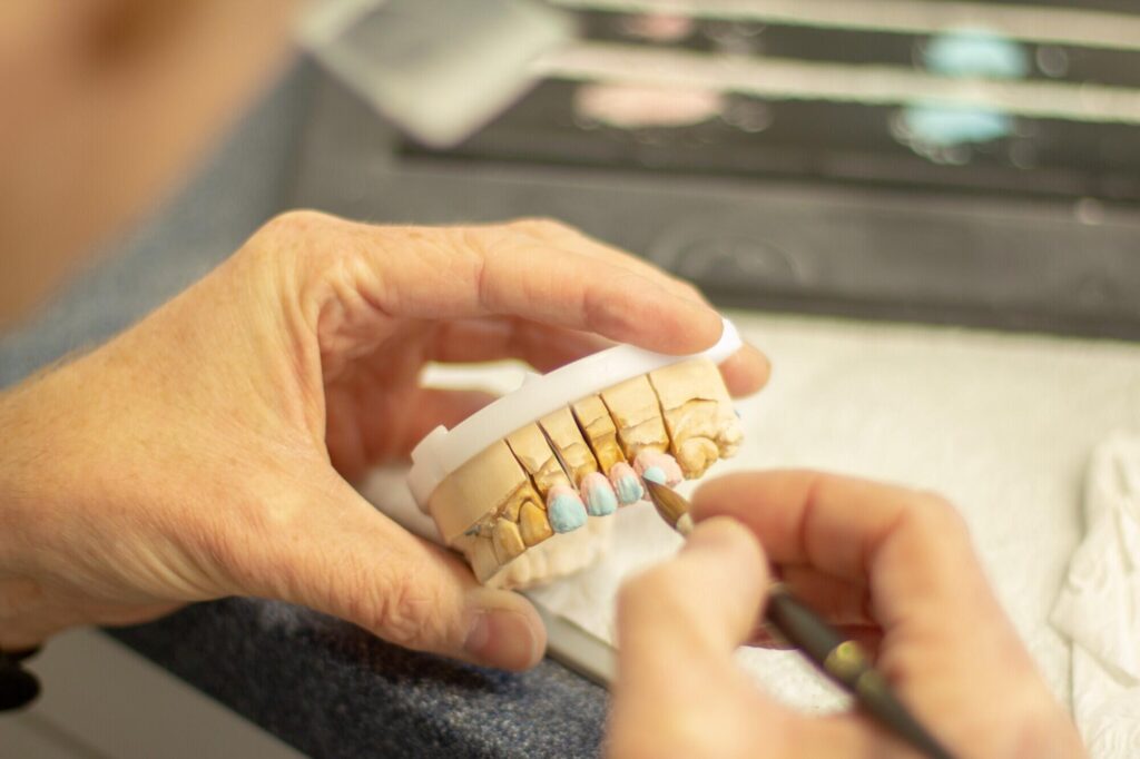 Tooth Replacement: Best Options for Missing Teeth