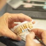 Tooth Replacement: Best Options for Missing Teeth