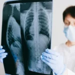 5 Must-Ask Questions After a Mesothelioma Diagnosis